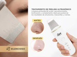 Kit Succinador de Puntos Negros X1 + Espatula Facial Cl50 Gadnic