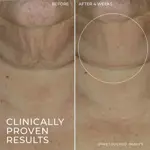 Sérum en barra RoC Derm Correxion Advanced Retinol Reafirmante 30 ml