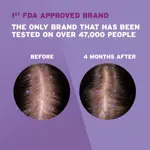 Tratamiento para el crecimiento del cabello Rogaine para mujeres, suministro de un mes