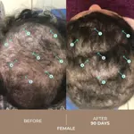 Sérum para el crecimiento del cabello DS Labs Spectral DNC-N 60 ml