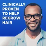 Tratamiento para el crecimiento del cabello Kirkland Minoxidil 5% para hombres, 12 oz