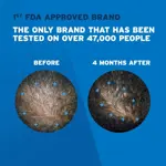 Espuma de tratamiento para el crecimiento del cabello Rogaine 5% Minoxidil, 3 meses