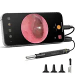 Otoscope ScopeAround Otoscope Ear Cámara de Otoscopio Vídeo 1080P FHD