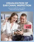Otoscope ScopeAround Otoscope Ear Cámara de Otoscopio Vídeo 1080P FHD