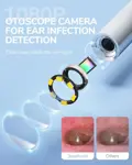 Otoscope ScopeAround Otoscope Ear Cámara de Otoscopio Vídeo 1080P FHD