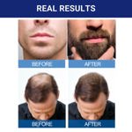 Tratamiento para el crecimiento del cabello Kirkland Signature Minoxidil 5%