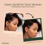 Sérum para el crecimiento del cabello NOOR HAIR Vitaminas naturales y aceite de argán