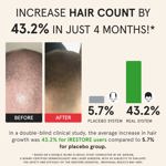 Sistema láser para el crecimiento del cabello iRestore Essential con paquete de baterías