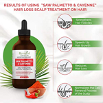 Tratamiento para la caída del cabello Botanical Green Care Saw Palmetto