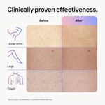 Dispositivo de depilación láser Braun IPL Skin i·Expert PL7243