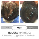 Sérum capilar DS Laboratories Spectral.dnc-S Hair Growth 5%