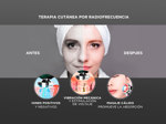 Kit Dermaroller + Cepillo Facial Masajeador LED - Rejuvenecedor
